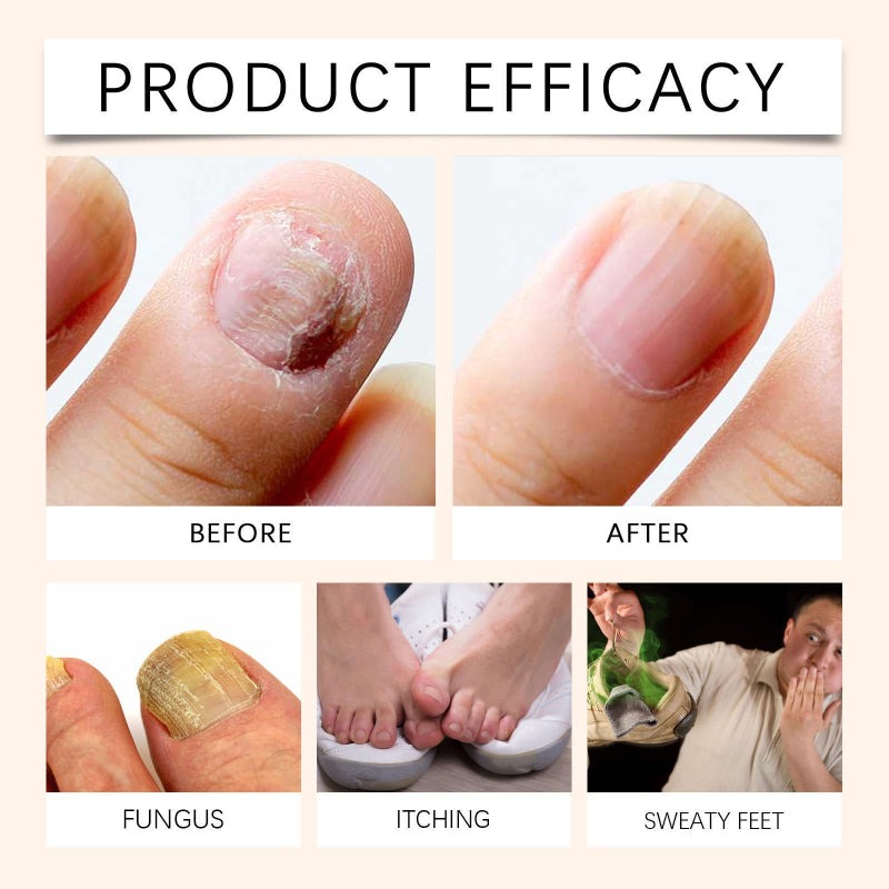 NailSpray 1+1 GRATIS - Nagelpflege Reparaturspray