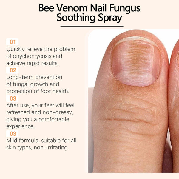 NailSpray 1+1 GRATIS - Nagelpflege Reparaturspray