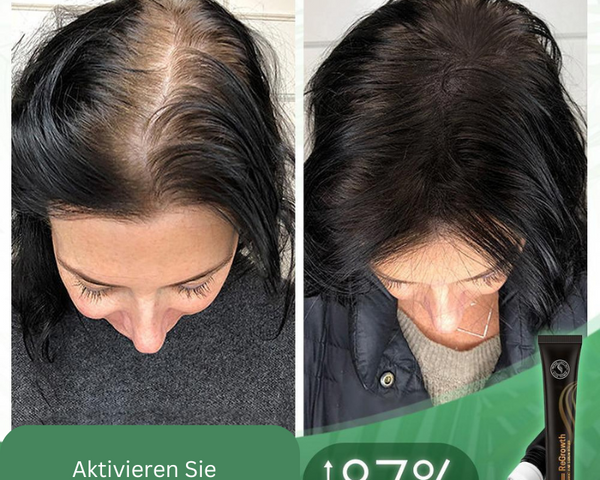 Regrowth™ Bio-Haar-Serum-Roller (1+1 gratis)