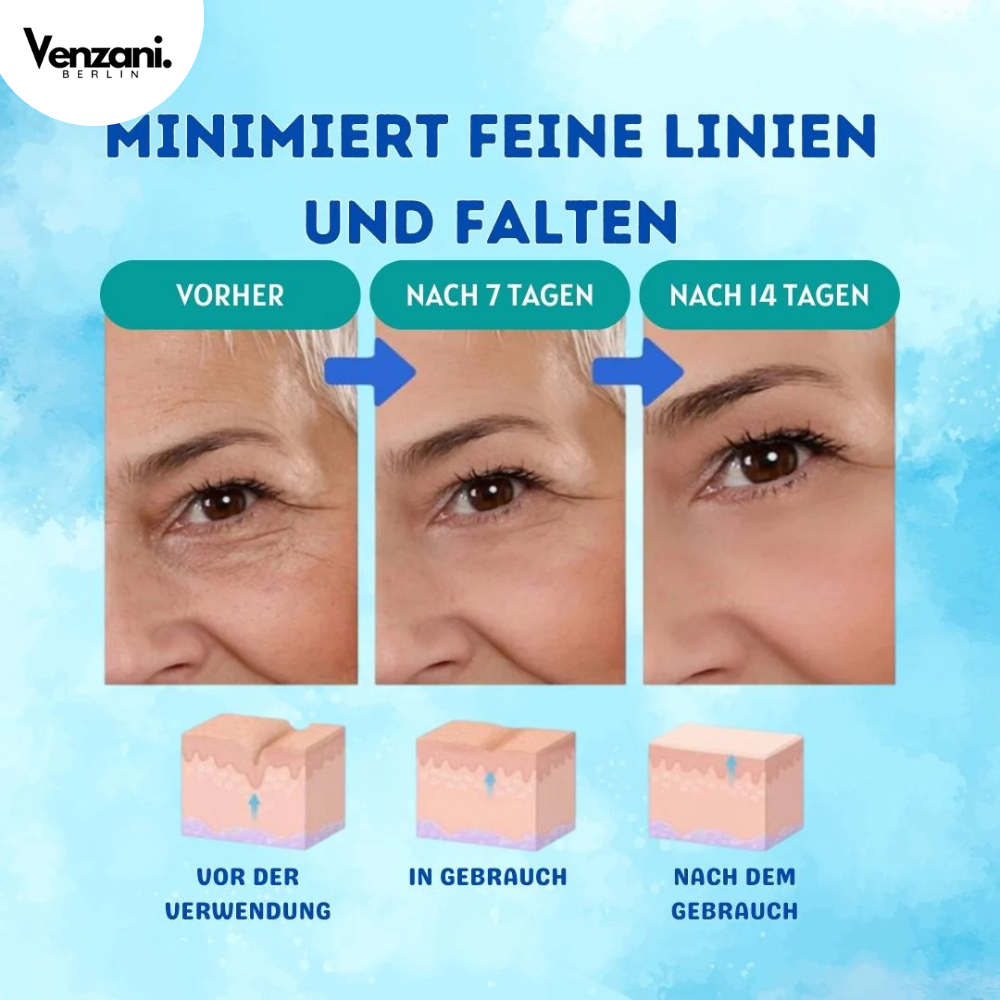 LETZTER TAG 1+1 GRATIS | YouthGlow™ | Botox Antialterung Serum