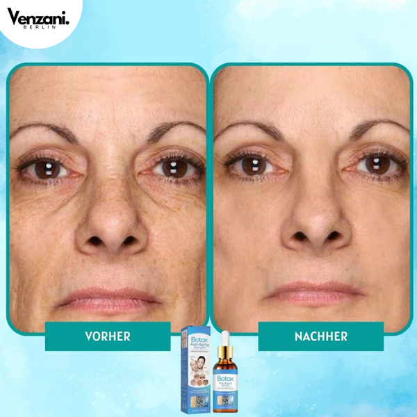 LETZTER TAG 1+1 GRATIS | YouthGlow™ | Botox Antialterung Serum