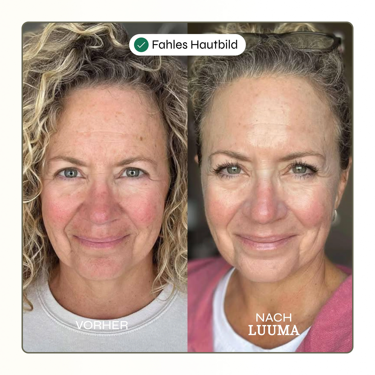 50% Rabatt | Kollagen Glow Maske™ | Straffere & frischere Haut schon nach der ersten Anwendung!