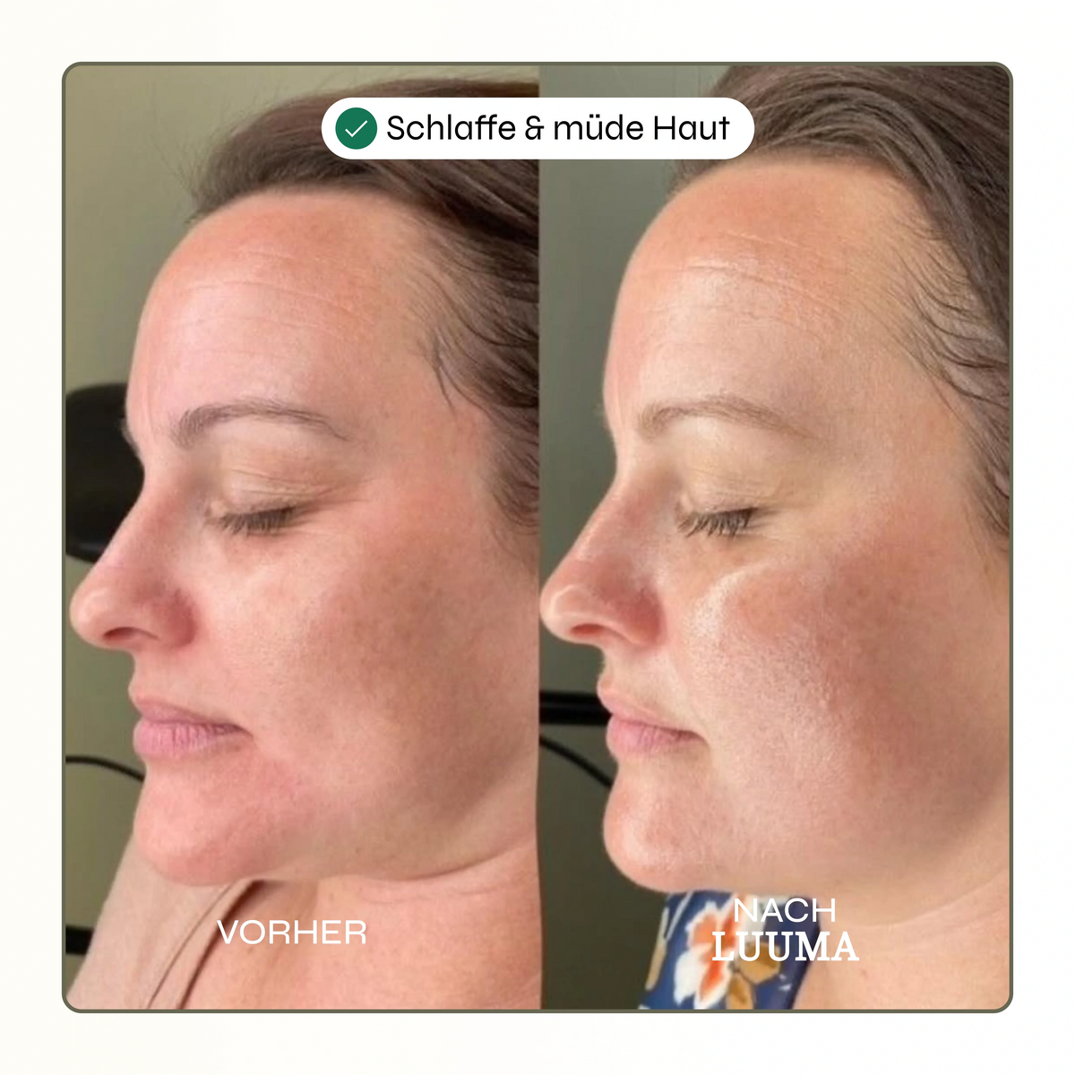 50% Rabatt | Kollagen Glow Maske™ | Straffere & frischere Haut schon nach der ersten Anwendung!
