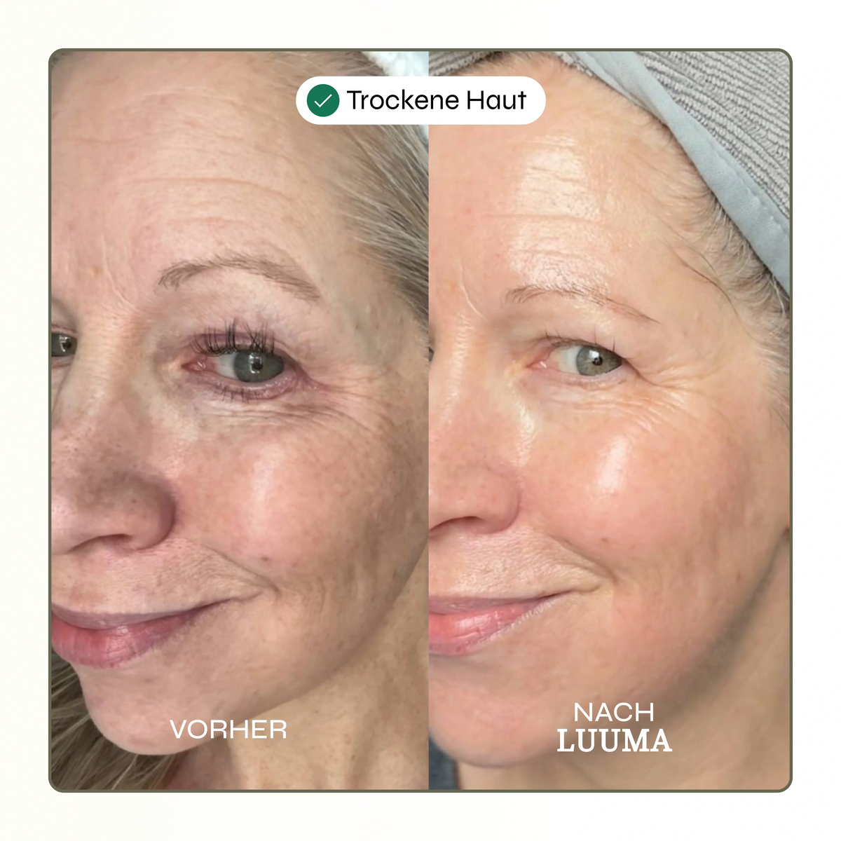 50% Rabatt | Kollagen Glow Maske™ | Straffere & frischere Haut schon nach der ersten Anwendung!