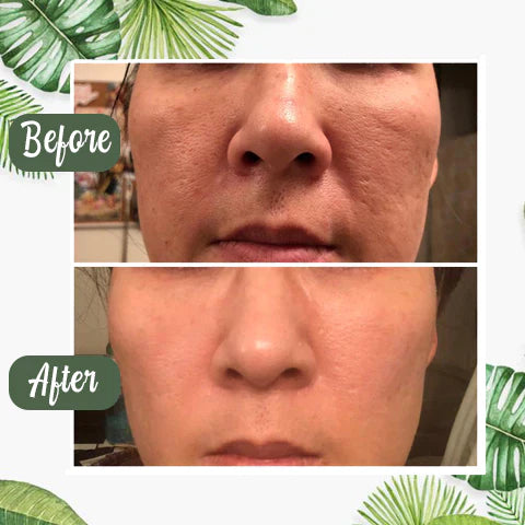 1+1 Gratis | BioBalance Mask™ | Grüner Tee Tiefenreinigungsmaske🍃