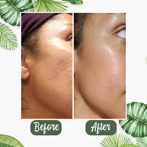 1+1 Gratis | BioBalance Mask™ | Grüner Tee Tiefenreinigungsmaske🍃