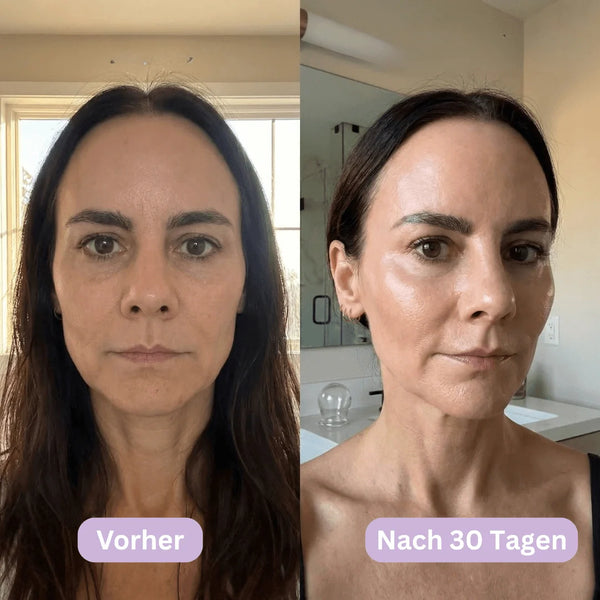 LymphCup™ | Schluss mit geschwollenem Gesicht