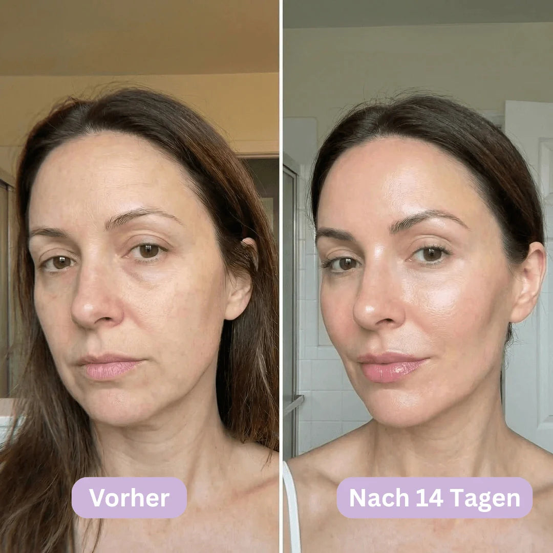 LymphCup™ | Schluss mit geschwollenem Gesicht