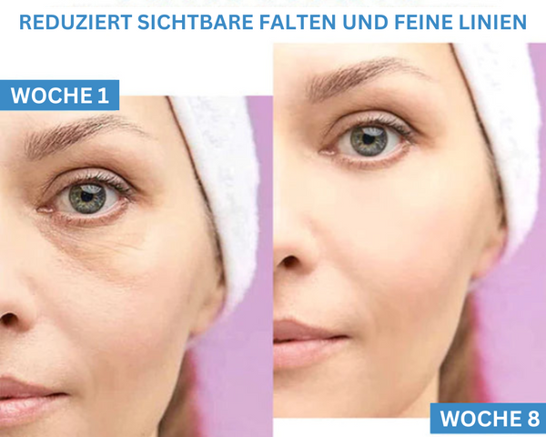 LeuchtendeAugen™ Augensackentferner und straffende Creme (1+1 gratis)