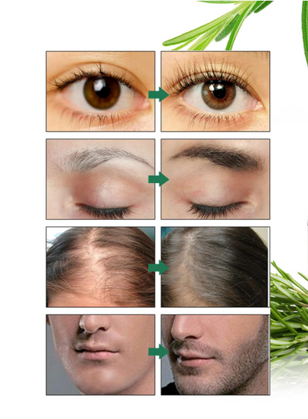 Rosmarinöl™ | Haarwachstum