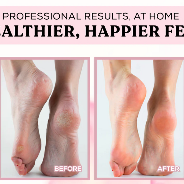 Sofheel™ | Starker Schutz für Ihre Füße