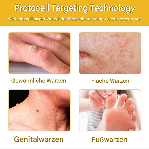 TagFree™ Warzen- & Hautanhängsel Pflege – Für Ein Ebenmäßigeres Hautbild