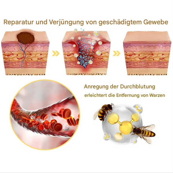 TagFree™ Warzen- & Hautanhängsel Pflege – Für Ein Ebenmäßigeres Hautbild
