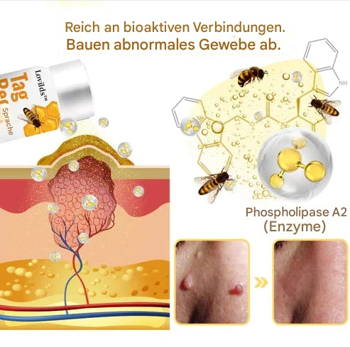 TagFree™ Warzen- & Hautanhängsel Pflege – Für Ein Ebenmäßigeres Hautbild