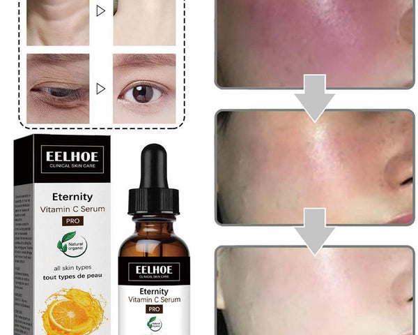EELHOE™️ Dark Spot Corrector Gesichtsserum