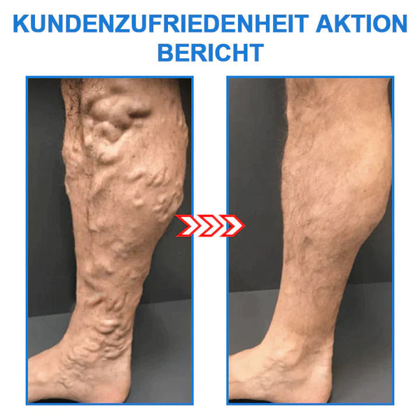 FormSocken™ - Schlanke Beine und straffe Haut in einem Schritt!