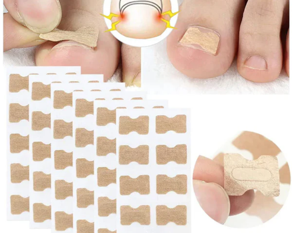 NailCare™ Sanfte Nagelkorrektur-Aufkleber