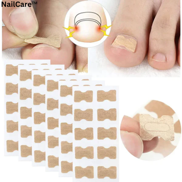 NailCare™ Sanfte Nagelkorrektur-Aufkleber