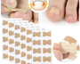 NailCare™ Sanfte Nagelkorrektur-Aufkleber