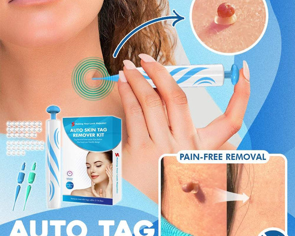 Warze verschwinden™ Kit zur Entfernung von Warzen