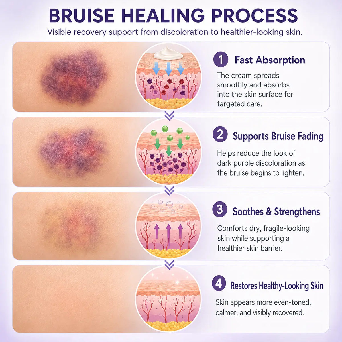 BruiseLuxe™ Hautregenerationscreme – Für Weniger Sichtbare Blutergüsse & Ein Ebenmäßigeres Hautbild
