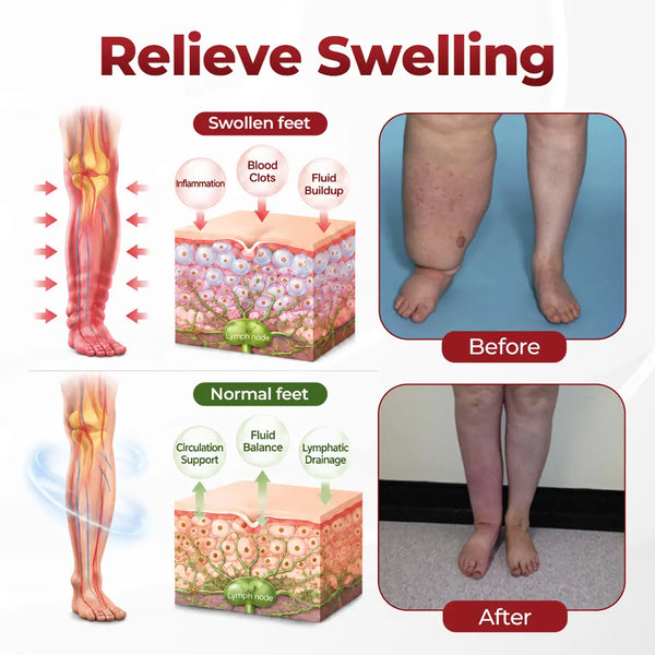 SwellEase™ Bein-Circulation-Creme – Für leichtere & weniger geschwollen wirkende Beine