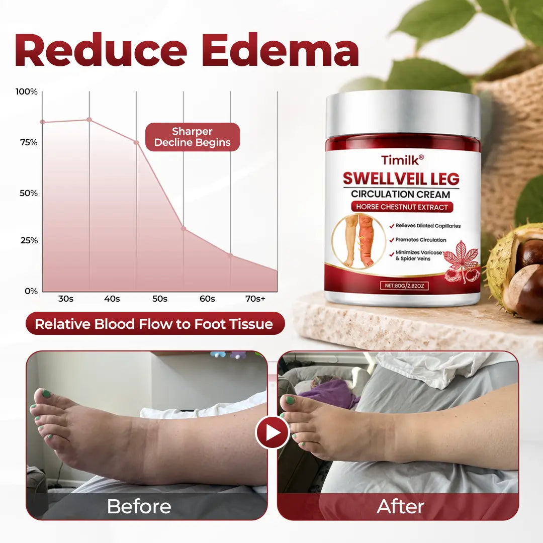 SwellEase™ Bein-Circulation-Creme – Für leichtere & weniger geschwollen wirkende Beine