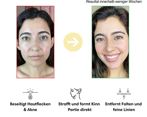 VerjüngungsKur™ Nacken- und Gesichtsmassagegerät