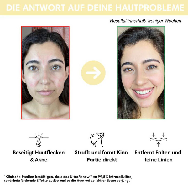 VerjüngungsKur™ Nacken- und Gesichtsmassagegerät