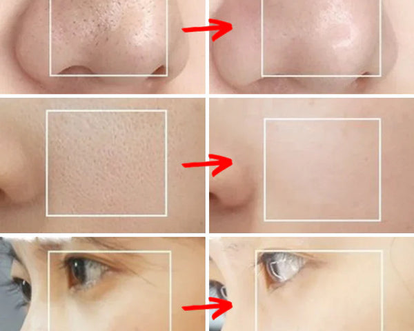 PoreCleaner™ | Effektiver Porenreiniger für klare Haut