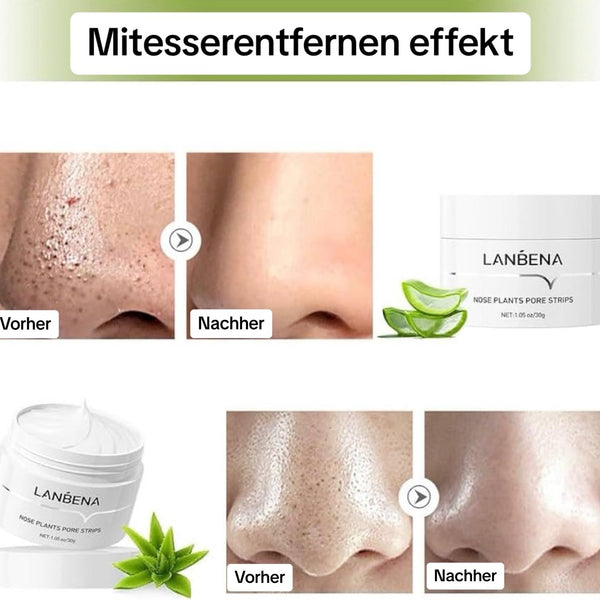 FrischerStreifen™ Porentiefe Reinigung