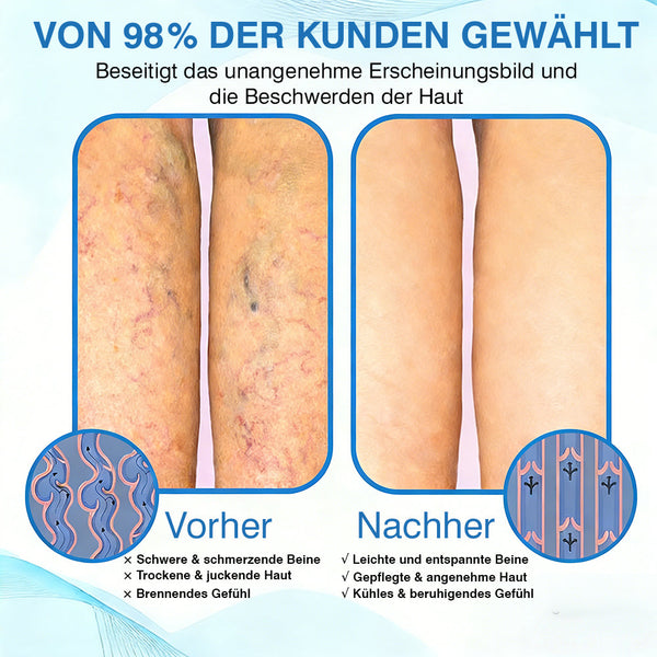 🇩🇪🏃‍🌿GFOUK® VascuCare Vein Healing Spray(Entwickelt für Krampfadern, Besenreiser, tiefe Venenthrombose (TVT), chronische venöse Insuffizienz, venöse Geschwüre, Thrombophlebitis und andere venöse Beschwerden)
