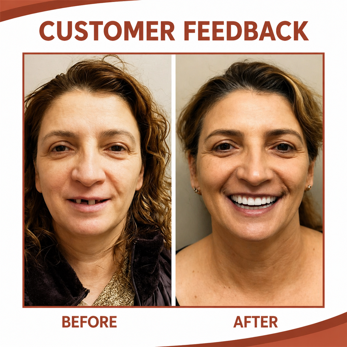 SmileFit™ | Zahnersatz-Komfortpolster – Für Einen Sicheren Halt Ohne Druckstellen