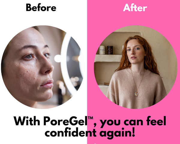 1+1 FREE | PorePerfekt™ Minimiert Poren sofort