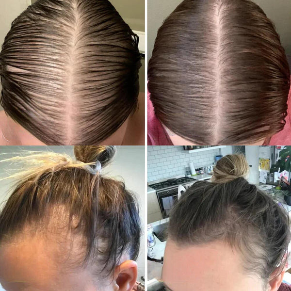 ReinesWachstum™ Haarwuchs-Öl