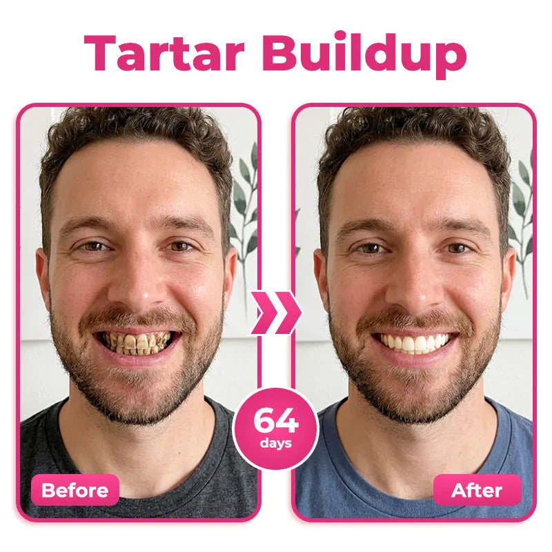 Dentiora™ NH-10 Enamel & Gum Advanced Therapy Zahnserum – Zahnschmelz stärken & Zahnempfindlichkeit lindern