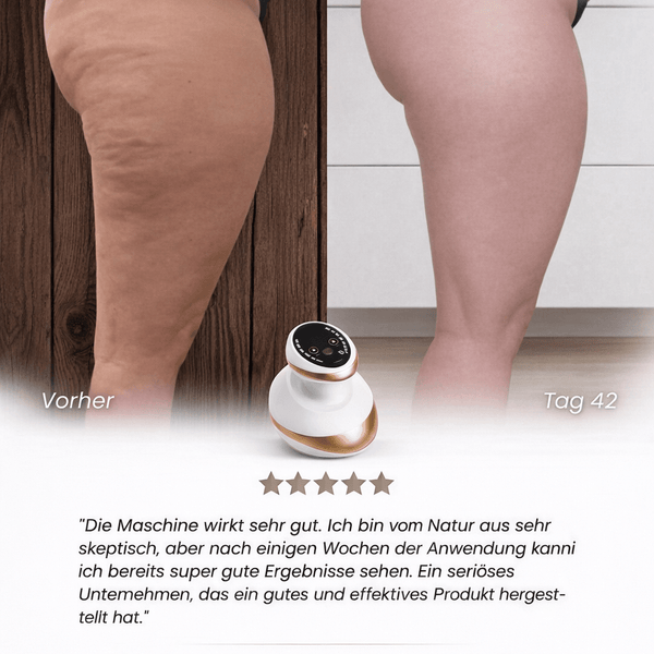 50% Rabatt | Vacumify Cellulite-Stop™ | Glattere & straffere Haut in nur 14 Tagen – von Zuhause aus!