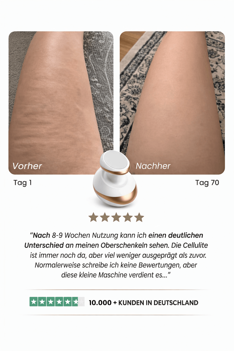 50% Rabatt | Vacumify Cellulite-Stop™ | Glattere & straffere Haut in nur 14 Tagen – von Zuhause aus!