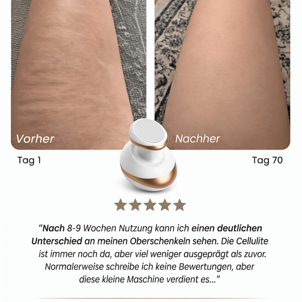 50% Rabatt | Vacumify Cellulite-Stop™ | Glattere & straffere Haut in nur 14 Tagen – von Zuhause aus!