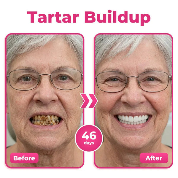 Dentiora™ NH-10 Enamel & Gum Advanced Therapy Zahnserum – Zahnschmelz stärken & Zahnempfindlichkeit lindern