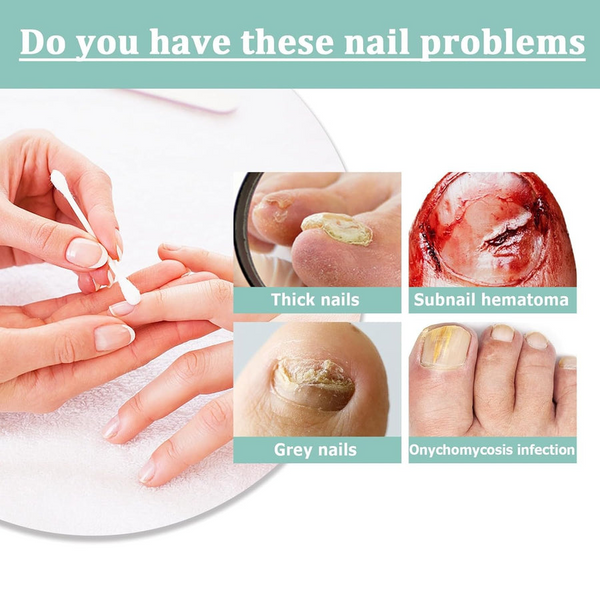 1+1 Gratis | VitaNail  | Natürlicher Nagelpflege-Stick | Für gesündere, Glänzende Nägel