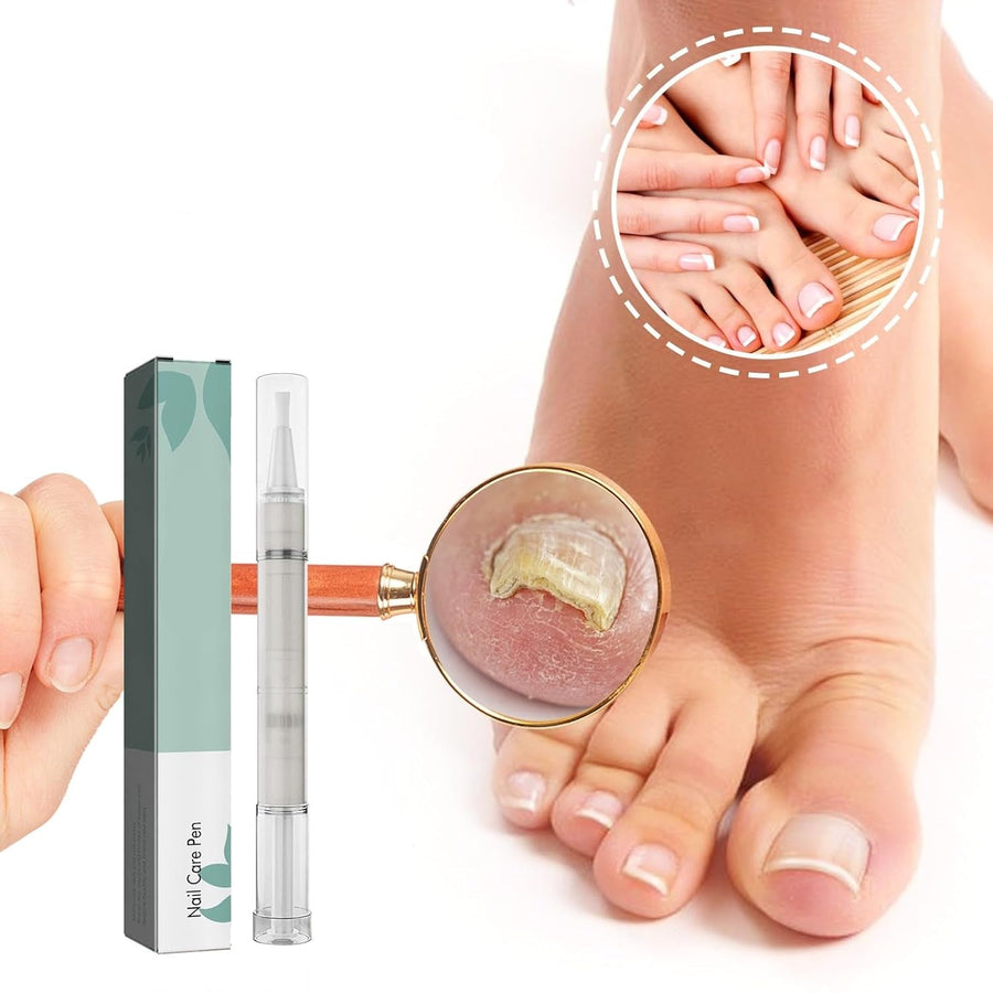 1+1 Gratis | VitaNail  | Natürlicher Nagelpflege-Stick | Für gesündere, Glänzende Nägel