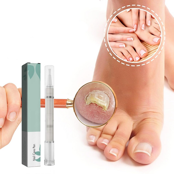 1+1 Gratis | VitaNail  | Natürlicher Nagelpflege-Stick | Für gesündere, Glänzende Nägel