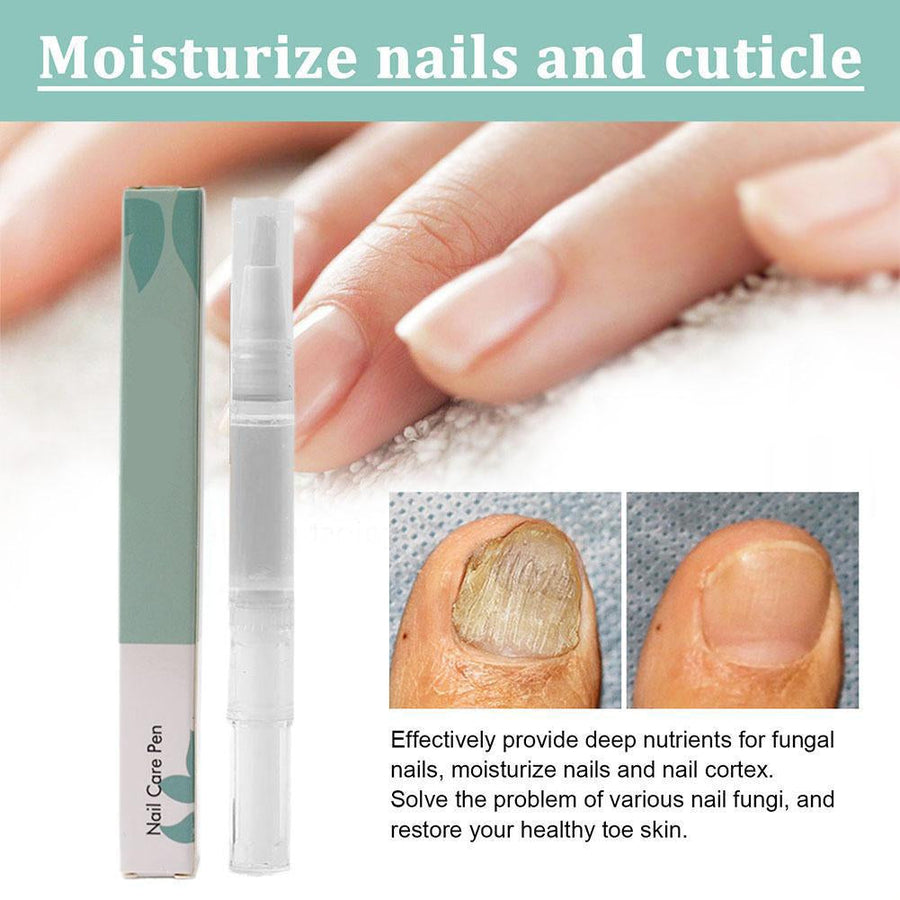 1+1 Gratis | VitaNail  | Natürlicher Nagelpflege-Stick | Für gesündere, Glänzende Nägel