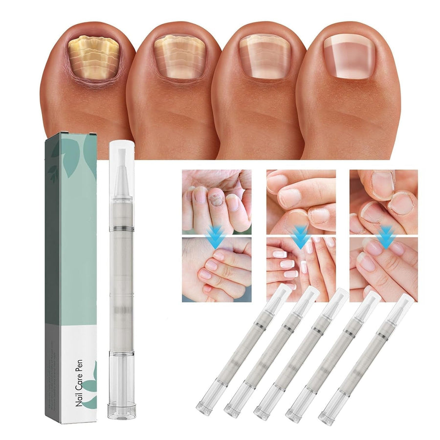 1+1 Gratis | VitaNail  | Natürlicher Nagelpflege-Stick | Für gesündere, Glänzende Nägel