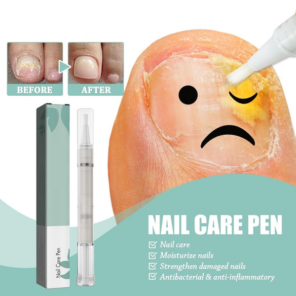 1+1 Gratis | VitaNail  | Natürlicher Nagelpflege-Stick | Für gesündere, Glänzende Nägel