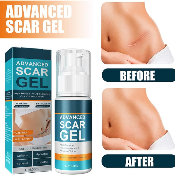 1+1  Gratis | Scar Relief Gel™ |  Beruhigen, Heilen, Erneuern