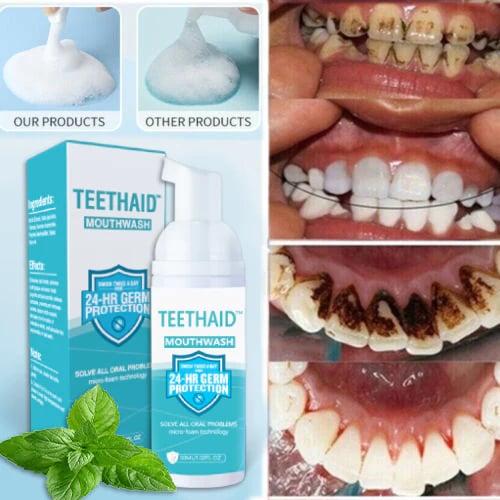 BrightMint™ Premium Mundspülung – Für Frischen Atem & Strahlend Gepflegte Zähne