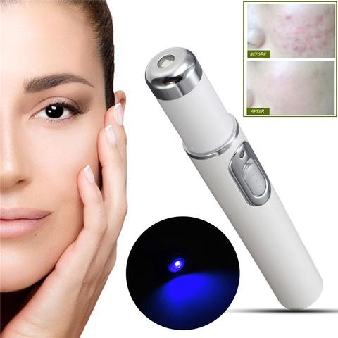 Laser Therapy™ | Keine Pickel und Akne mehr!