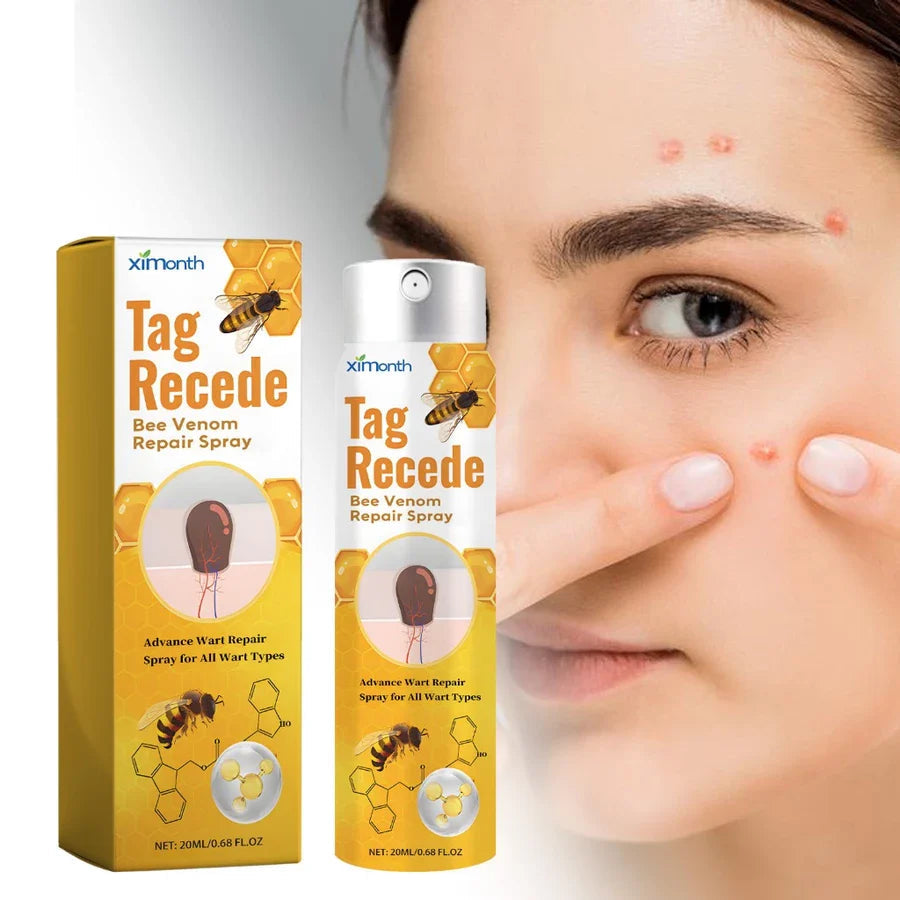 TagFree™ Warzen- & Hautanhängsel Pflege – Für Ein Ebenmäßigeres Hautbild